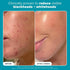 Paula's Choice SKIN PERFECTING 2% BHA Liquid Salicylic Acid Exfoliant-Facial Exfoliant for Enlarged Pores, Wrinkles & Fine Lines and Suitable for Blackhead-Prone Skin